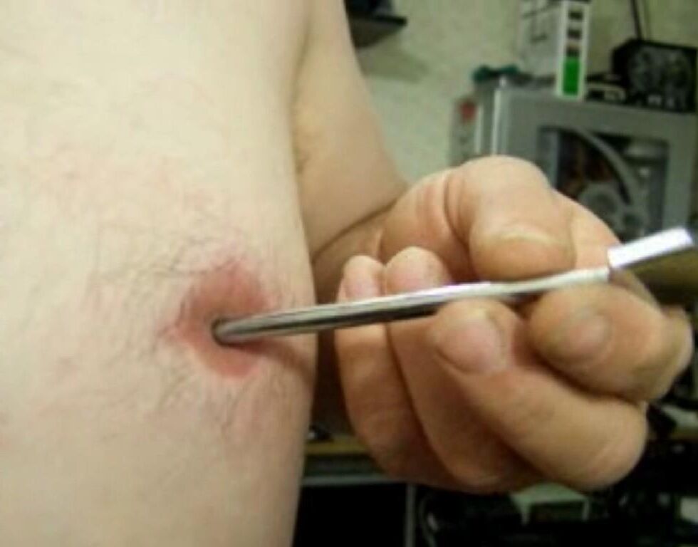 Inverted, modified nipples - penetration: 5 cm deep, 7 mm wide!!