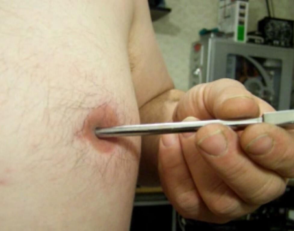 Inverted, modified nipples - penetration: 5 cm deep, 7 mm wide!!