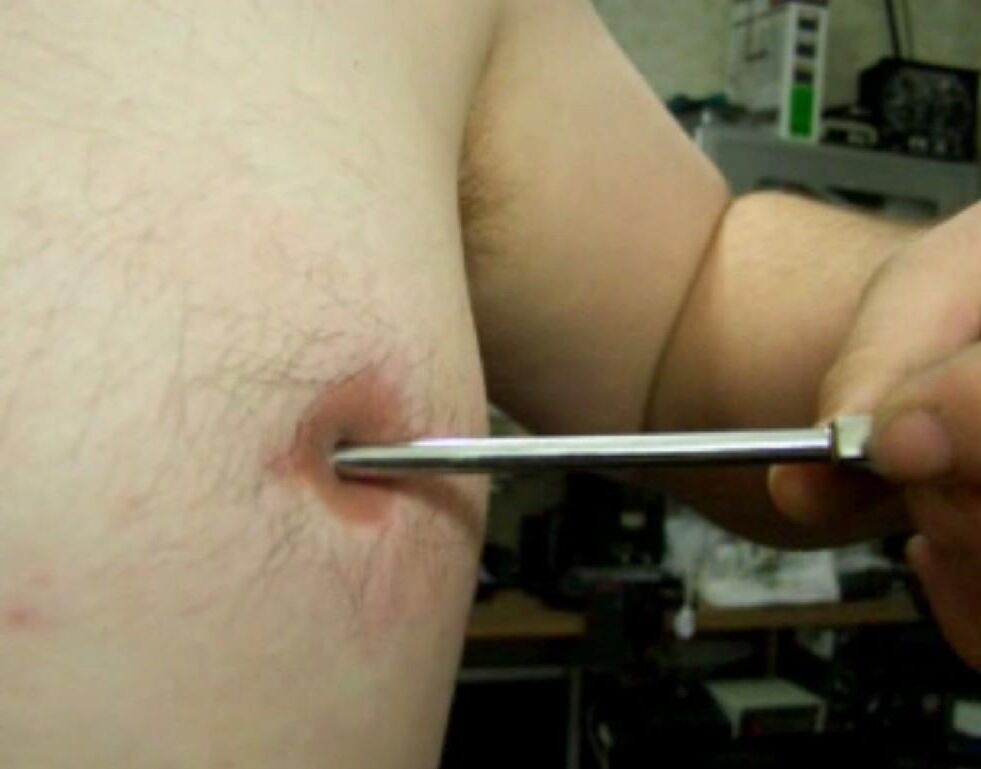 Inverted, modified nipples - penetration: 5 cm deep, 7 mm wide!!