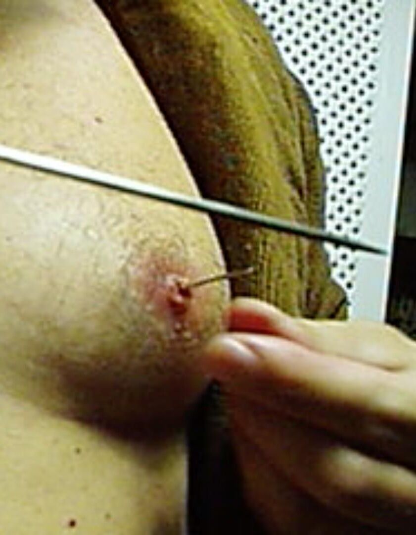 Nipples are already inverted after all this abusing-new/old pics