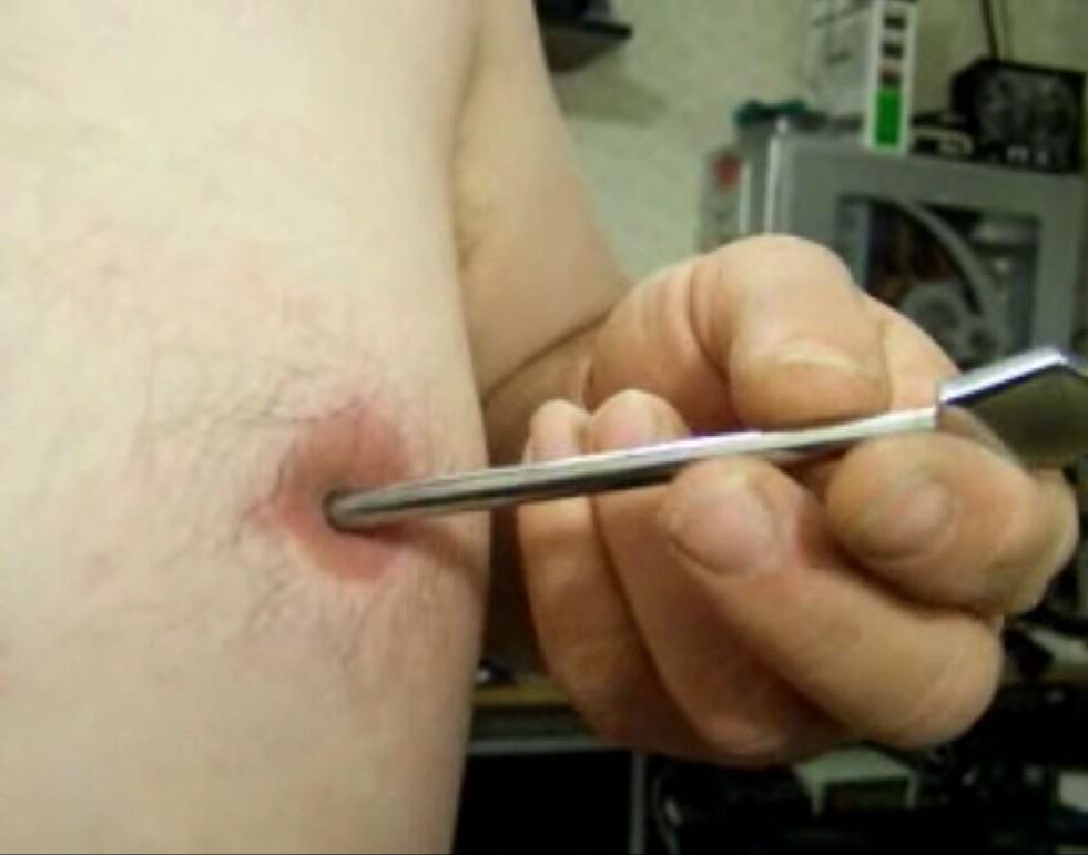 Inverted, modified nipples - penetration: 5 cm deep, 7 mm wide!!