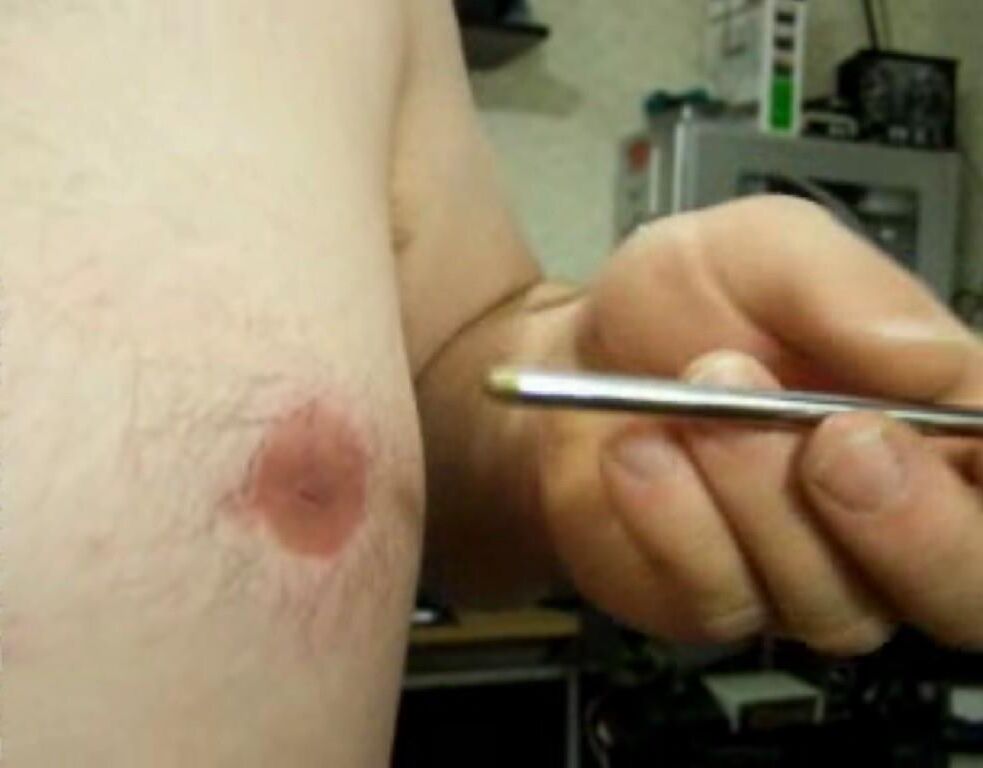 Inverted, modified nipples - penetration: 5 cm deep, 7 mm wide!!