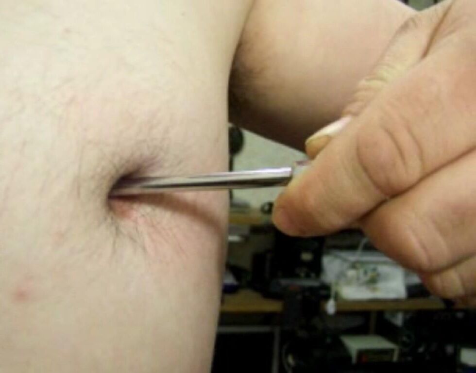 Inverted, modified nipples - penetration: 5 cm deep, 7 mm wide!!