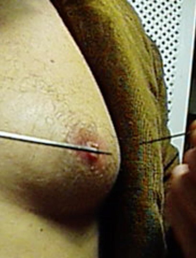 Nipples are already inverted after all this abusing-new/old pics