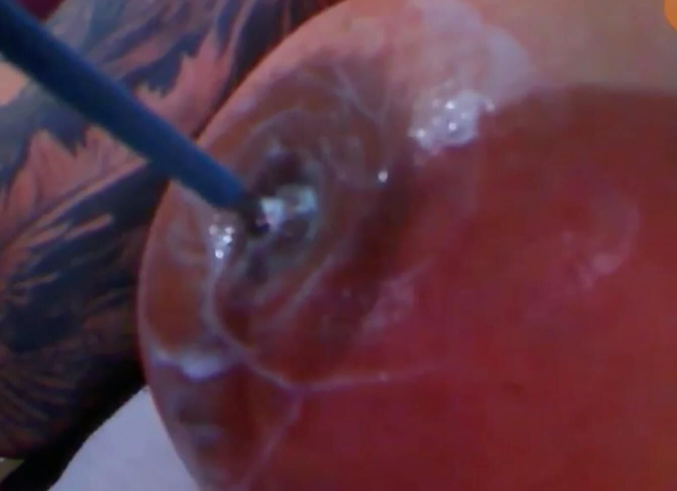 Inserting needles and skewers in nipples - making them inverted