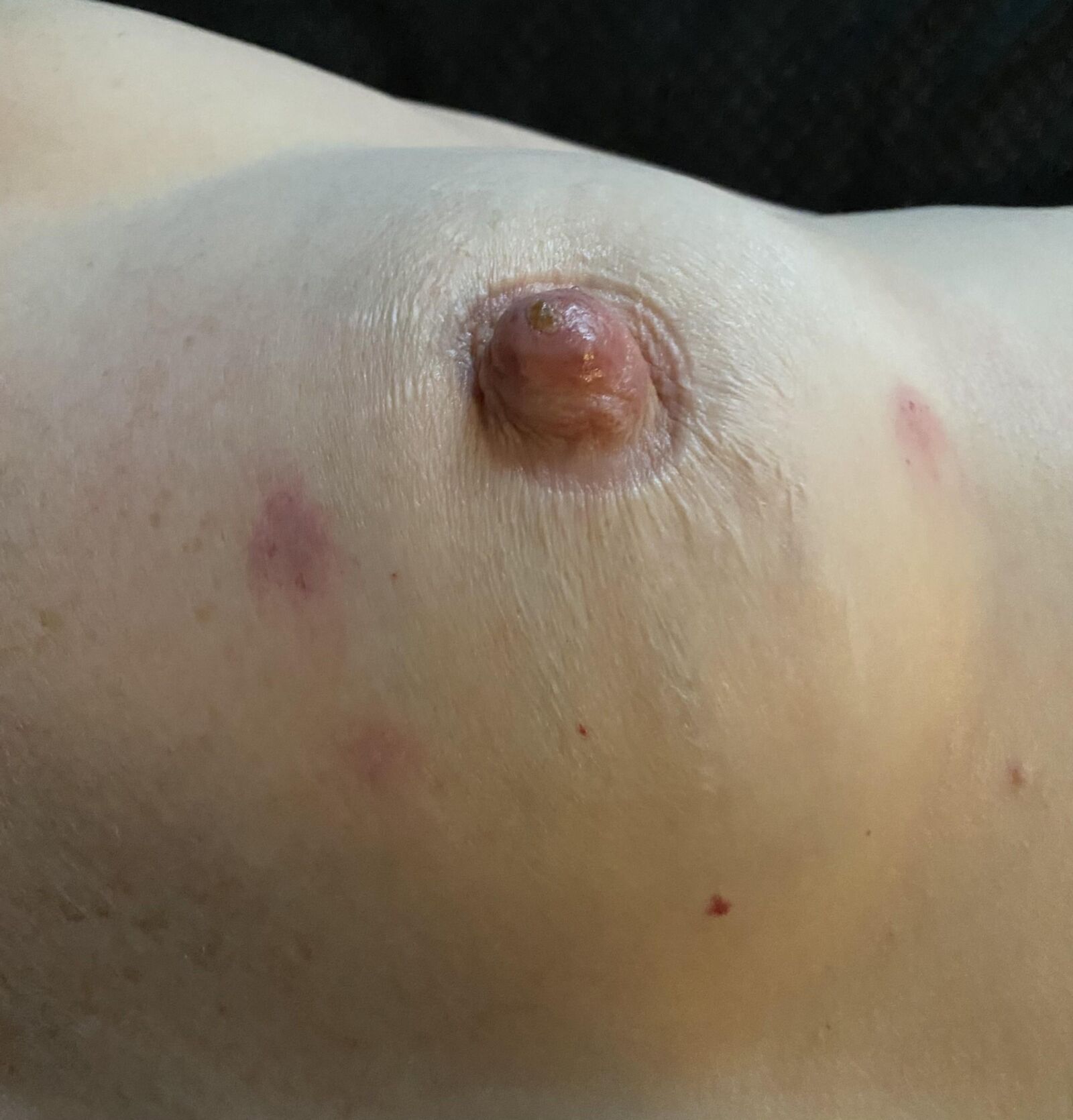 Big Nips Pumped and Bitten