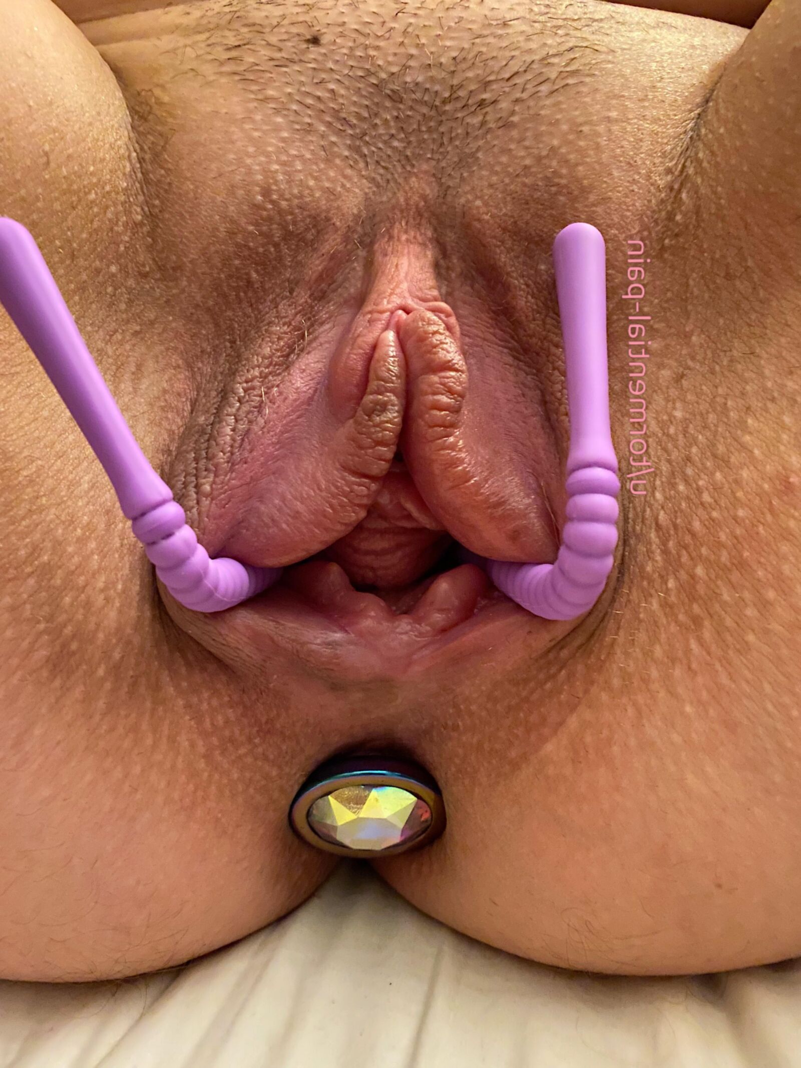 dor atormential