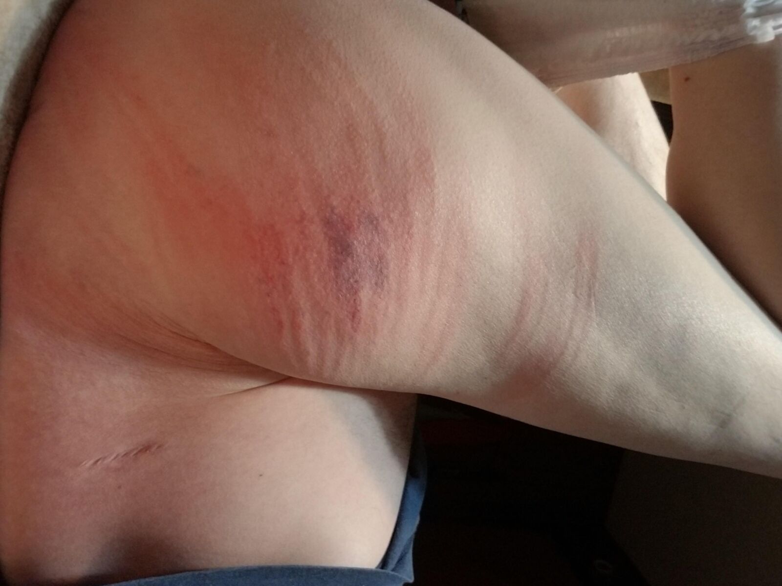 A good old fashioned garden hose whipping
