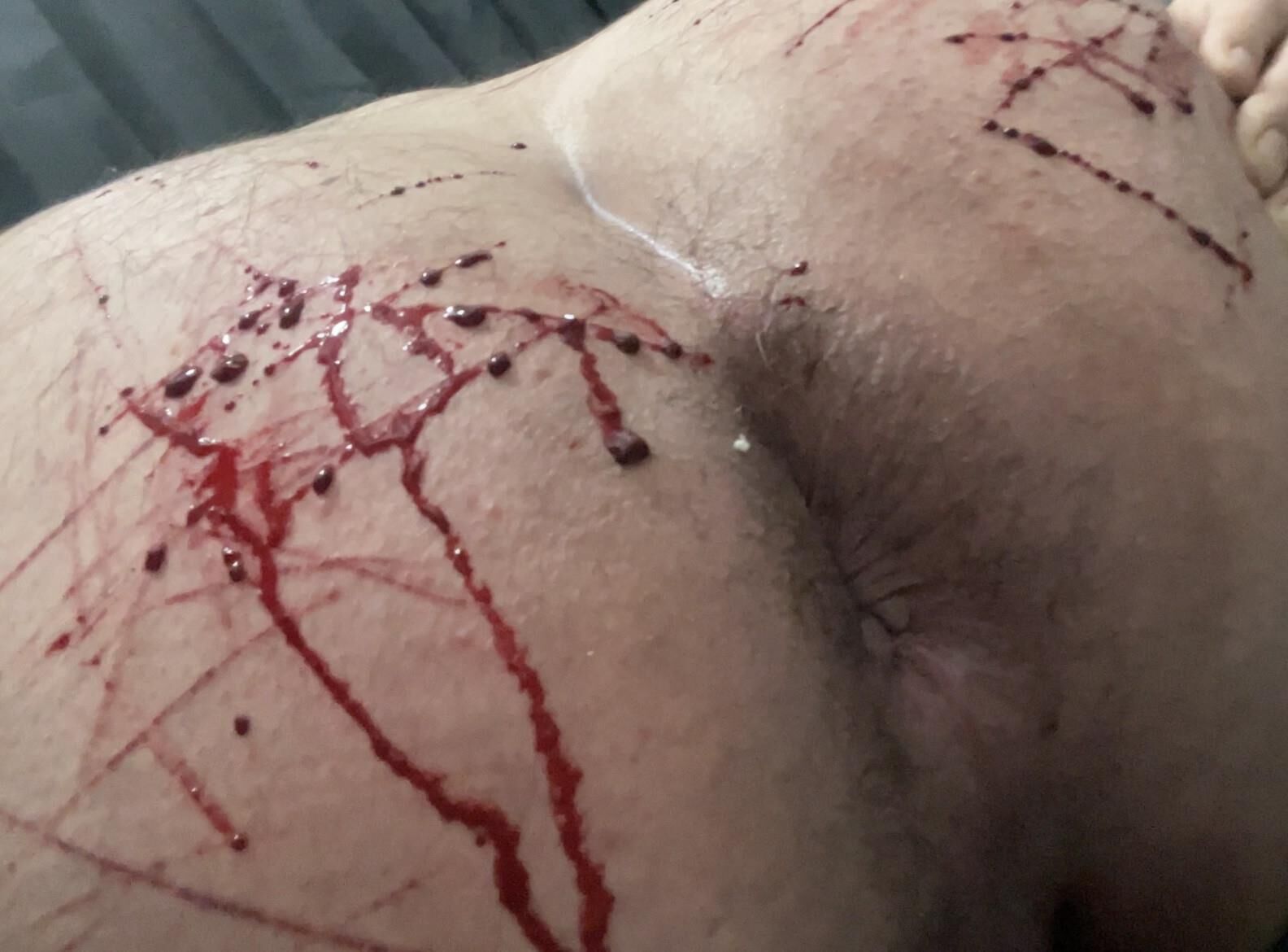 Auto-torture, sang réel