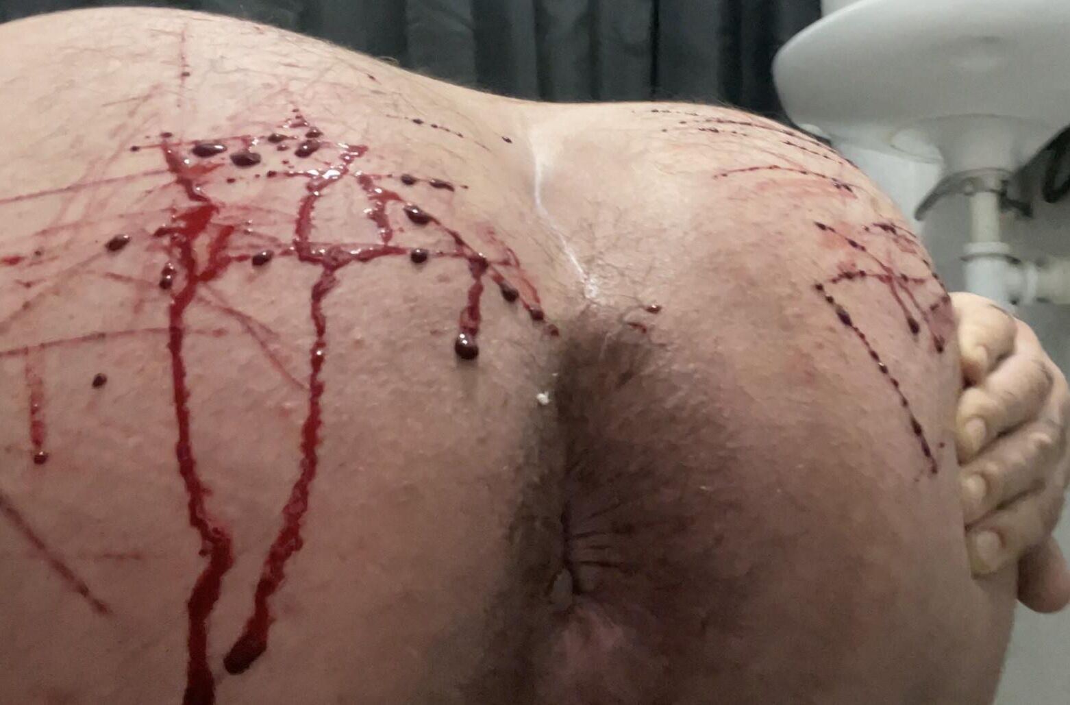 Auto-torture, sang réel