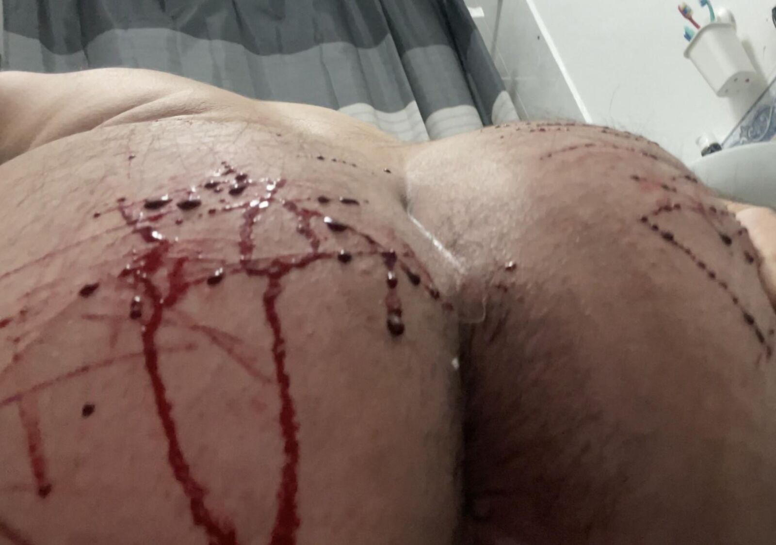Auto-torture, sang réel