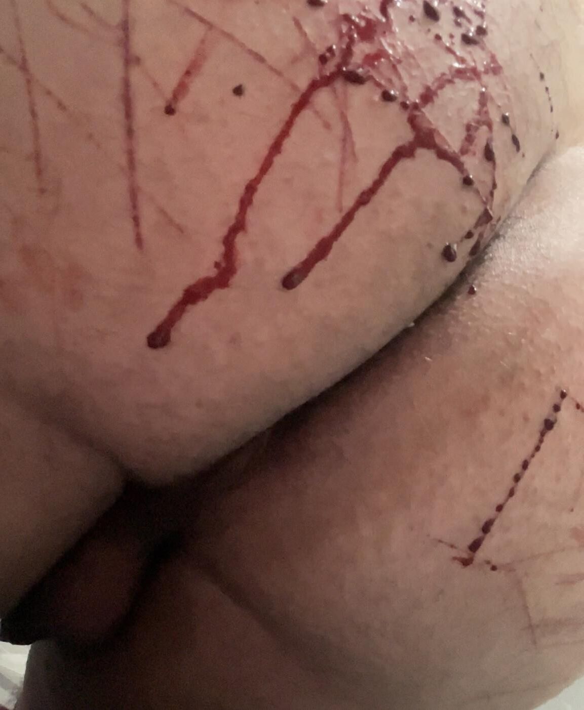 Auto-torture, sang réel