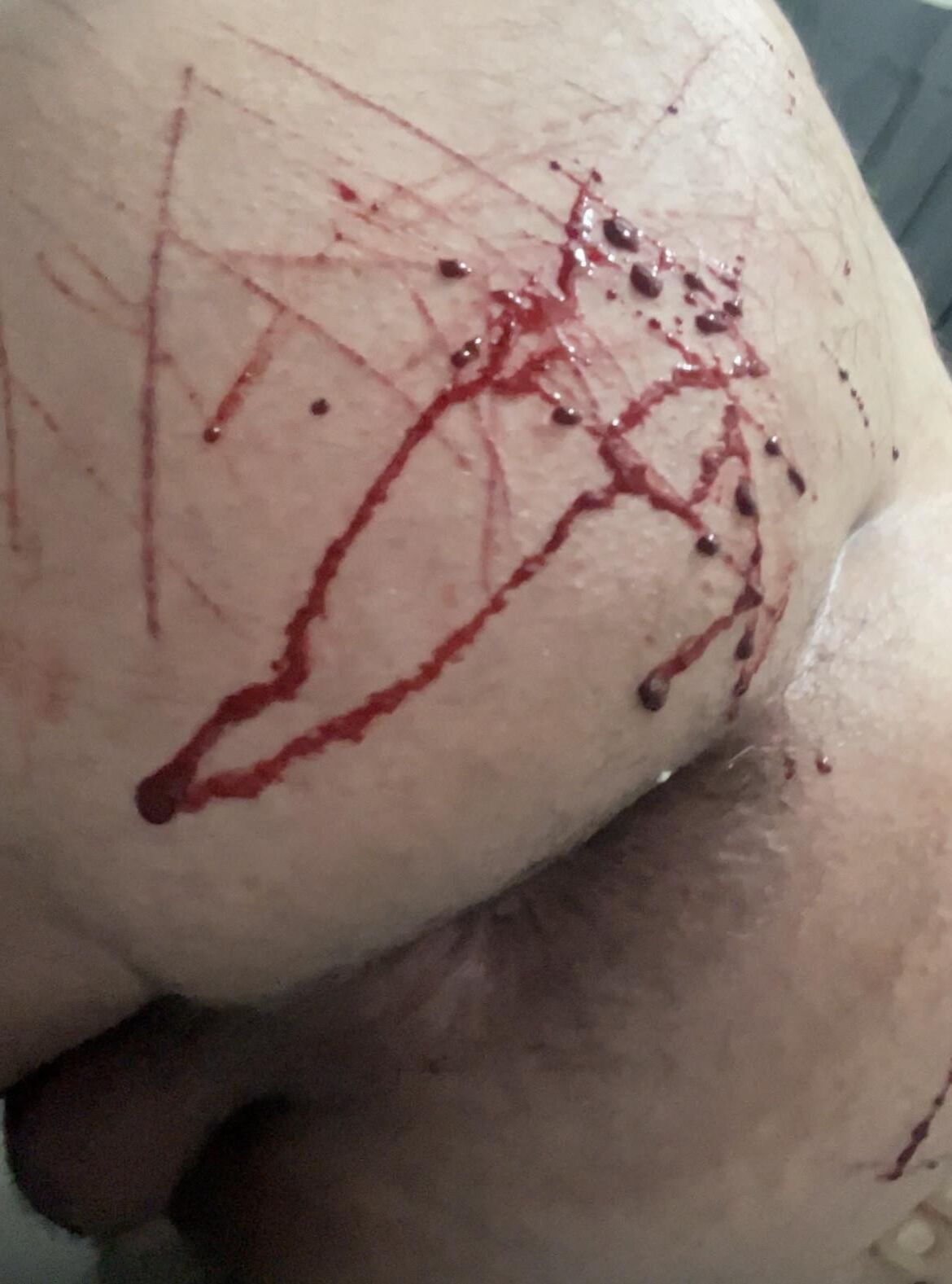 Auto-torture, sang réel