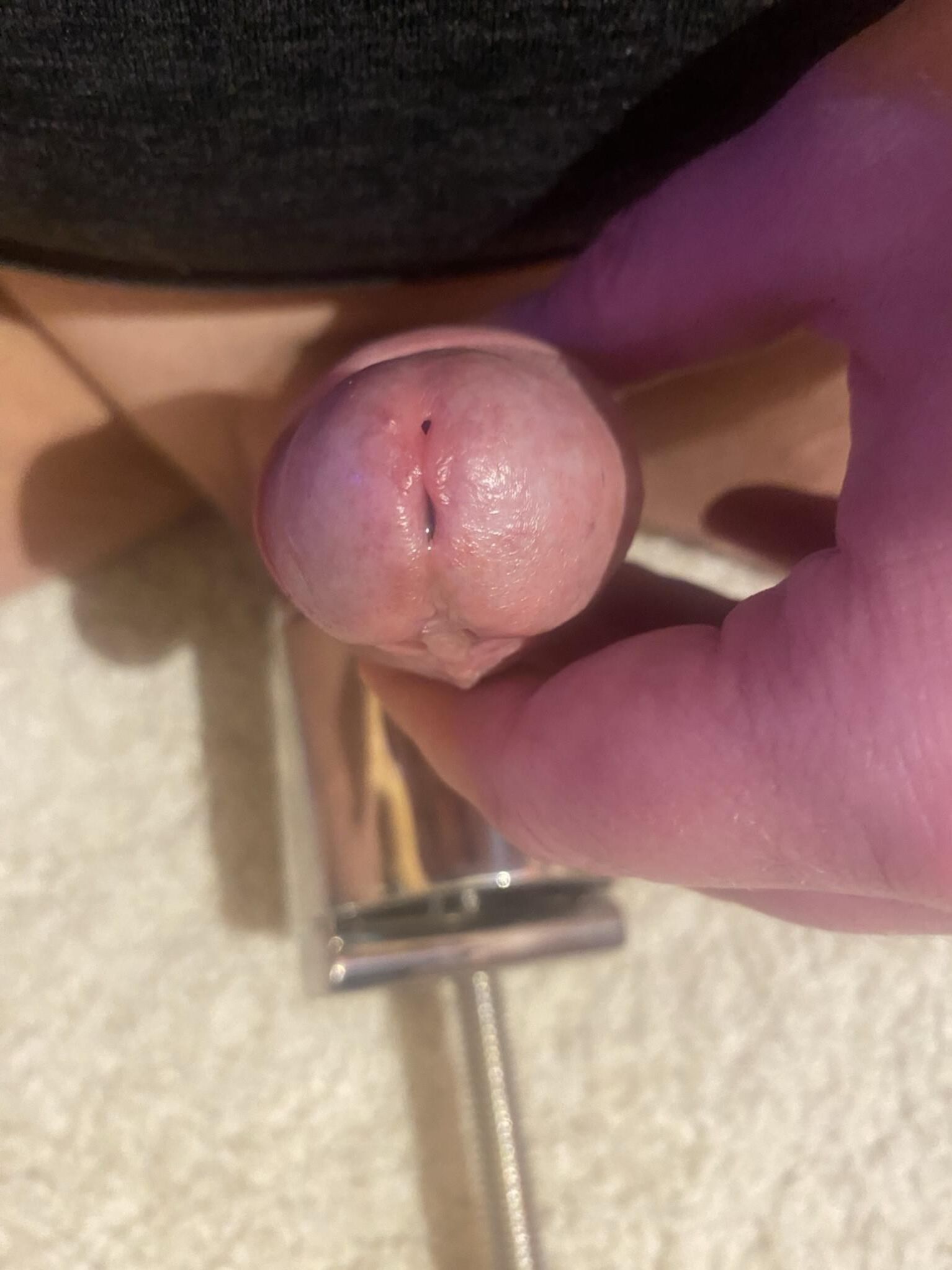 Bolas esmagadas à ejaculação indesejada sem orgasmo