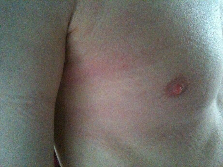 痛みのある男性もいます