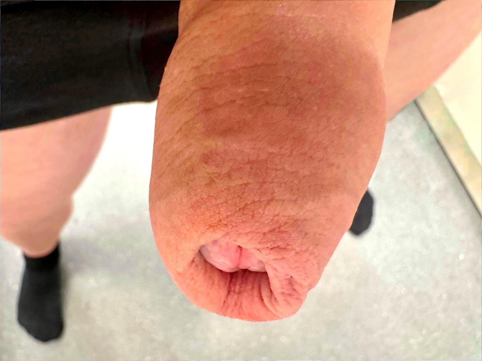 私の性器への注射