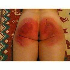 Eles merecem bundas vermelhas