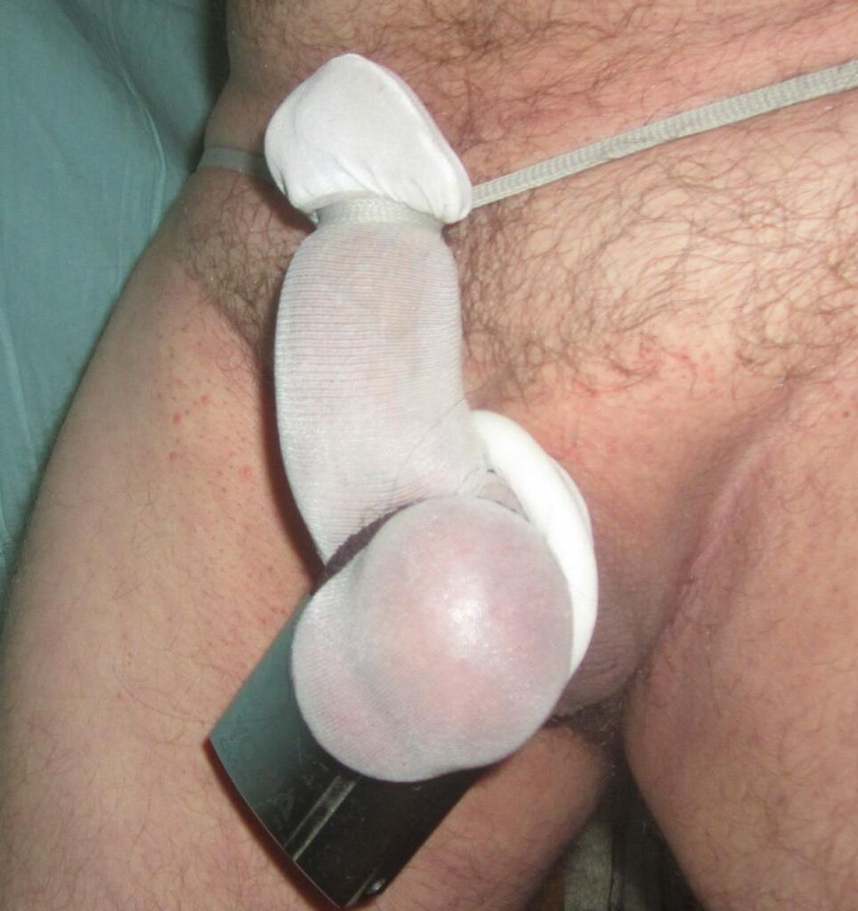 CBT